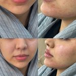 کلینیک ژل بوتاکس لیزر فیل بیوتی