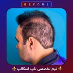 اولین مرکز میکرواسکالپ مشهد تاپ اسکالپ