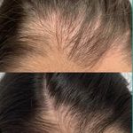 مرکزتخصصی خدمات پوست وفیشال ناهید پناهی