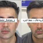 کلینیک زیبایی و لیزر لوتوس