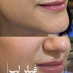 مطب زیبایی آرا