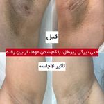 مرکز لیزر وکلینیک زیبایی پایون(بانوان)