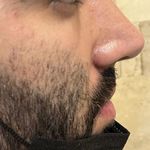 کلینیک زیبایی الماس کاملا اقساطی