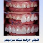 دندانپزشکی آریان بیمه تکمیلی با بیهوشی