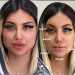 کلینیک زیبایی بلا