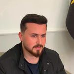 کاشت مو تبریز سونیتا