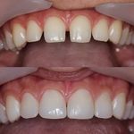 دندانپزشک دینا شعاعی