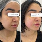 کلینیک پوست،مو و لیزر زینا مختاری