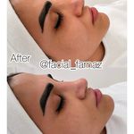 فیشیال فرناز