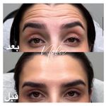 کلینیک زیبایی و لیزر مو زائد نوبا