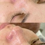 خدمات تخصصی پاکسازی پوست فروغ یزدانی