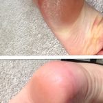 خدمات تخصصی پدیکور درمانی شیوا