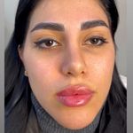 کلینیک زیبایی شایلی