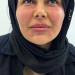 کلینیک تخصصی ژل و بوتاکس مرضیه آقابابایی