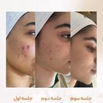 کلینیک فیشال و ماساژ سارن اسکین سارا