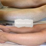 کلینیک لیزر موهای زائد نیوانتا