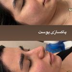 آرایشگاه زنانه إلماه