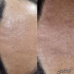 فیشال و پاکسازی پوست  آیلار شاهوردی
