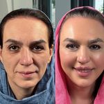 مجموعه زیبایی آتی‌ماه