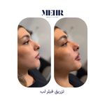 کلینیک زیبایی مهر