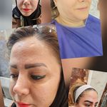 کلینیک زیبایی پوست و مو آتریسا