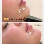 کلینیک پوست و مو و لیزر نیلوفر آبی