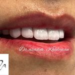 دندانپزشکی دکتر آزاده خلجیان