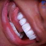 دندانپزشکی پرتو صادقیه از دم قسط با بیمه