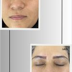 خدمات تخصصی فیشال و پاکسازی پوست صبا