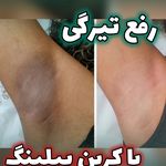 کلینیک پوست مو زیبایی و لیزر کهربا