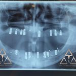 کلینیک دندانپزشکی تیدنتا