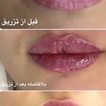 مطب پوست، مو و زیبایی و لیزر شبیرا