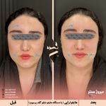 مرکز پزشکی و زیبایی میروژ سنتر