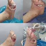 کارشناس زخم و متخصص کیوم تراپی بهرامی فر