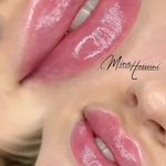 میکروبلیدینگ و شیدینگ مینا حسینی