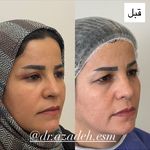 کلینیک زیبایی و لیزر دکتر آزاده اسماعیلی