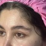 کلینیک زیبایی الماس کاملا اقساطی