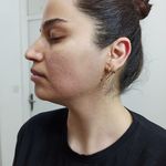 خدمات تخصصی پاکسازی پوست و فیشال مریم