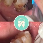 مطب دندانپزشکی دکتر سیده زهرا پسته ای