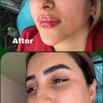 کلینیک پوست،مو و لیزر زینا مختاری