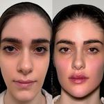 مجموعه زیبایی آتی‌ماه