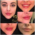 کلینیک پوست و زیبایی ولاغری تاج عظیمیه