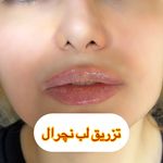 دکتر زیبایی حاجی زاده