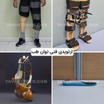ارتوپدی فنی توان طب