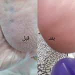 پدیکور و کف سابی
