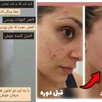 محصولات لدورا