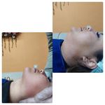 فیشال درمانی و پاکسازی پوست میرجلیلی