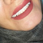 مطب ایمپلنت دکتر نیما شفیعی