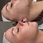 پاکسازی پوست و مو مهسام