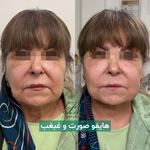کلینیک زیبایی فرتاک